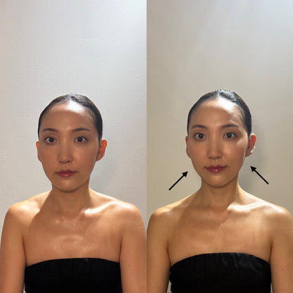 V-LINE EAR SEED KIT